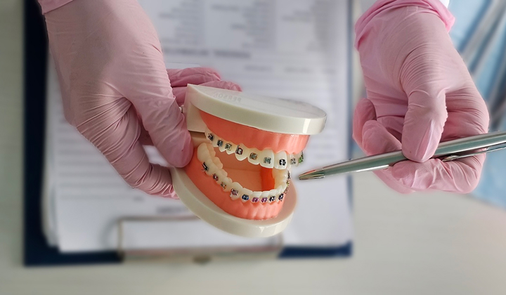 Close Of Of Orthodontist Pointing At Model Of Teeth Wearing Braces