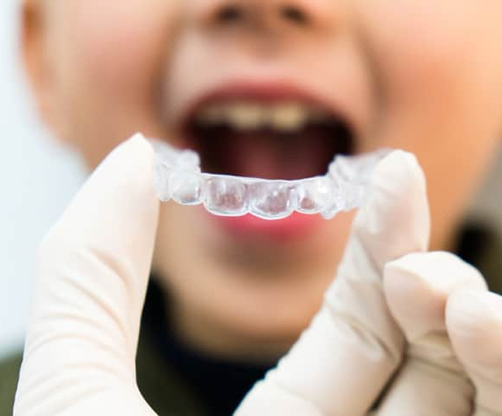 Close Up Of Orthodontist Inserting Clear Aligner Into Childs Mouth