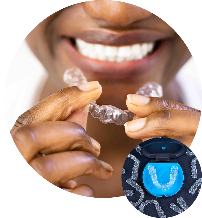 Close Up Of Smiling Woman With Invisalign Aligner