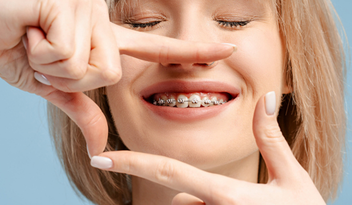 White Woman Framing Her Smile Wearing Braces