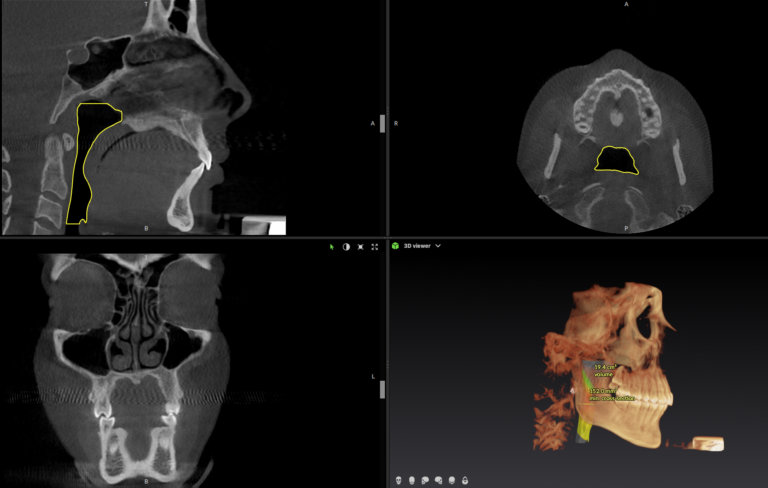 3d Cbct Imaging Skull Scan